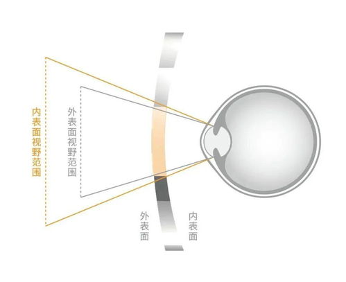專為中國孩子設計 明月鏡片推出‘輕松控’青少年近視管理鏡片